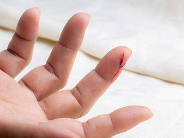 Pasted 93 Trong giấc chiêm bao thấy người thân bị đứt tay chảy máu
